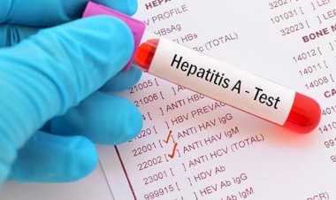 Pobreza, golpes de calor y hepatitis A